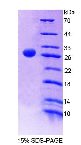 Human SRSF1 / SF2 Protein (Recombinant His-T7)