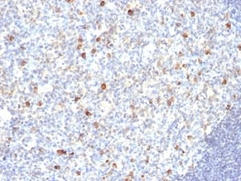 Mouse Anti-Human IgM Secondary Antibody (clone SPM188)