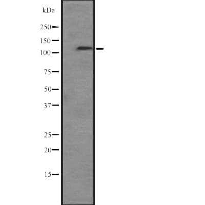 PIK3CB / PI3K Beta Antibody