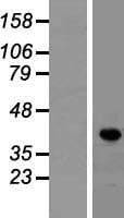 LDB1 / CLIM2 Protein (Over-Expression Lysate Myc-DDK (Flag))