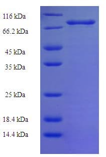 Human XIAP Protein (Recombinant His-SUMO)