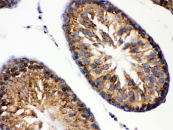 HSPA5 / GRP78 / BiP Antibody