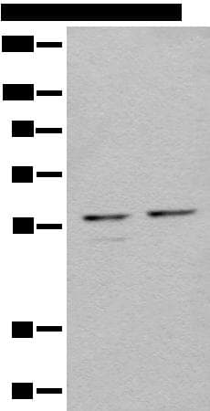 URI1 / NNX3 Antibody