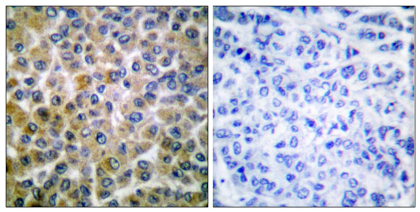 SMAD1 Antibody (p465)