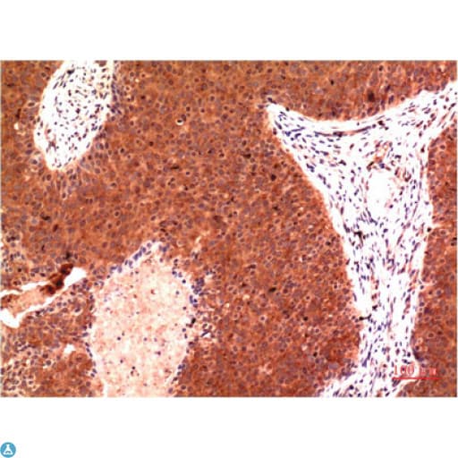 Monoclonal Mouse anti-Human TUBG1 / Tubulin Gamma 1 Antibody (IHC, WB)