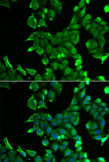 STOM / Stomatin Antibody