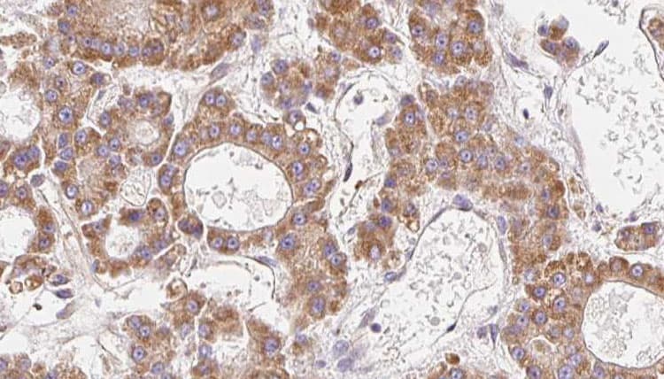 CLDN14 / Claudin 14 Antibody