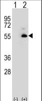 Polyclonal Rabbit anti-Human ALDH3A2 Antibody (IHC, WB)