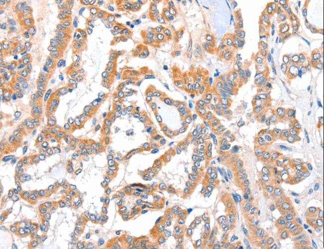 ACSBG1 / hsBG Antibody