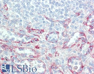 IHC-plus™ PDGF-D Antibody (aa191-370)