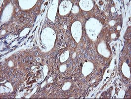 MAP2K1 / MKK1 / MEK1 Antibody (clone OTI4E1)