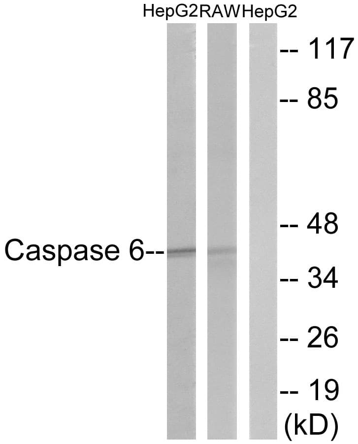 CASP6 / Caspase 6 Antibody (aa223-272)