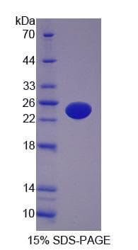 Human AFF1 / AF4 Protein (Recombinant His-S)