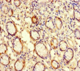 ATG16L2 Antibody