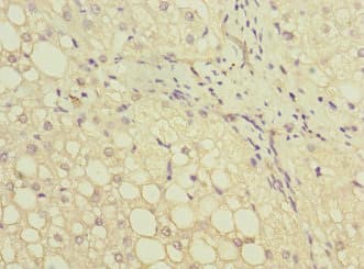 Polyclonal Rabbit anti-Human GATC Antibody (IHC)