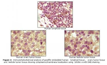 Monoclonal Mouse anti-Human INHA / Inhibin Alpha Antibody (clone 4A2A9, 4A2F7, 4A2F2, IHC, WB)