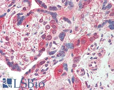 PathPlus™ PD-L2 / PDCD1LG2 / CD273 Antibody (clone 10H6)