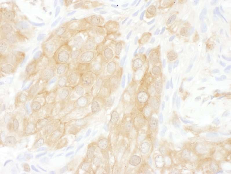YWHAQ / 14-3-3 Theta Antibody (aa100-150)