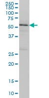 Monoclonal Mouse anti-Human TOM1 Antibody (clone 5A3, IHC, WB)