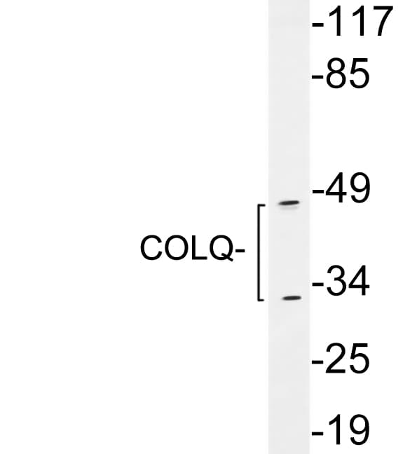 COLQ Antibody (aa189-238)