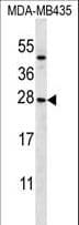 KLRC1 / NKG2A / CD159a Antibody (aa1-30)