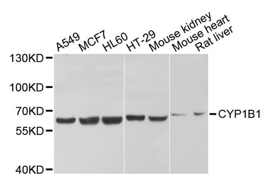 CYP1B1 Antibody