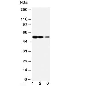 AGER / RAGE Antibody (aa174-192)