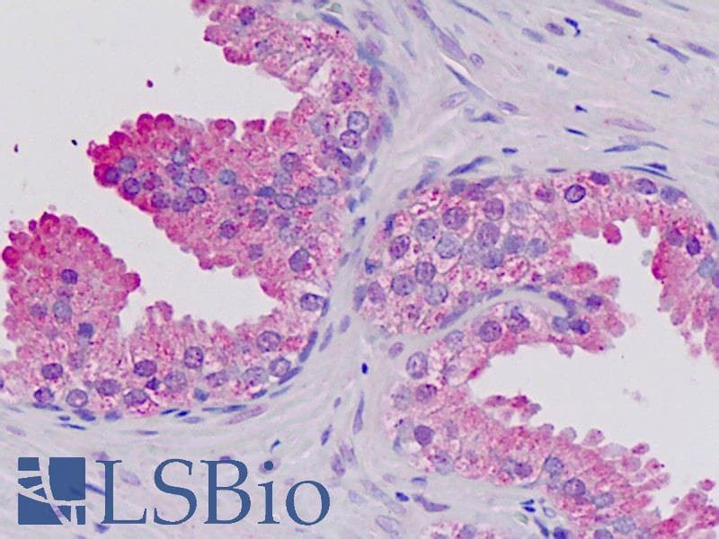 IHC-plus™ Polyclonal Rabbit anti-Human AFF1 / AF4 Antibody (aa1181-1210, IHC, WB)