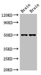 GFAP Antibody