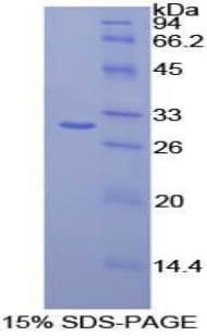 Human CELSR2 Protein (Recombinant His-T7)