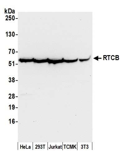RTCB / C22orf28 Antibody (aa455-505)