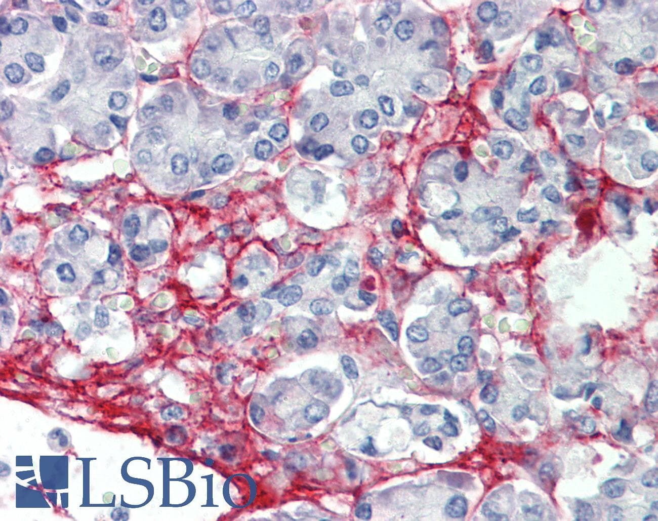 IHC-plus™ FN1 / Fibronectin Antibody (aa1965-2176, clone 2F4)