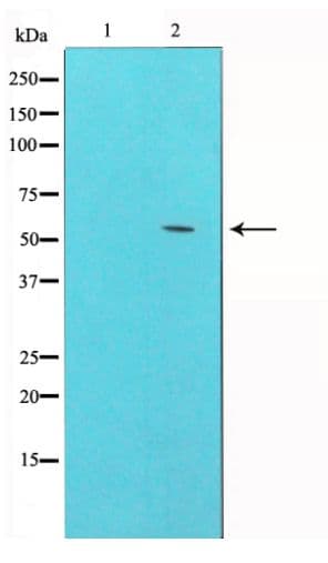 Polyclonal Rabbit anti-Human GSK3A / GSK3 Alpha Antibody (phospho-Ser21, IHC, WB)