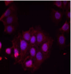 ER Alpha / Estrogen Receptor Antibody