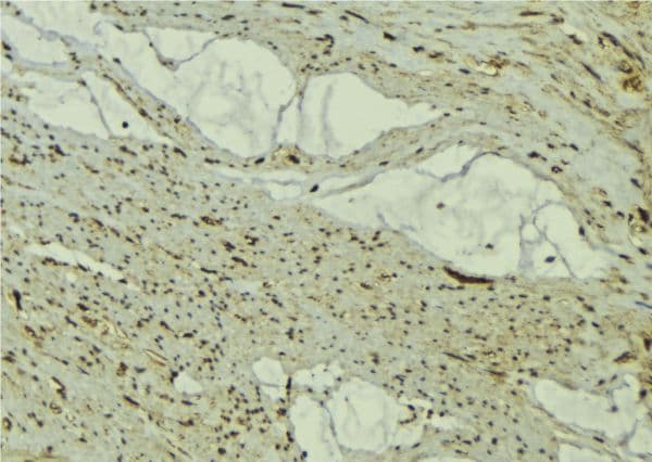 FBXO32 / Fbx32 Antibody