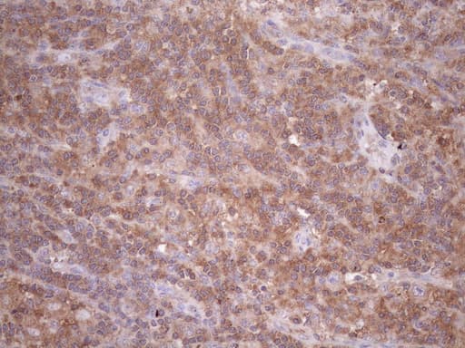 TNFRSF10B / Killer / DR5 Antibody (aa203-411, clone OTI2A5)