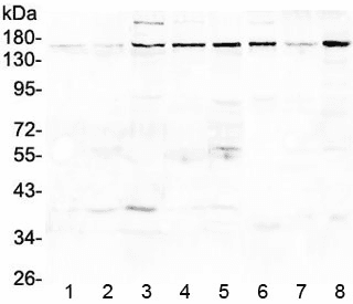 Polyclonal Rabbit anti-Human EEA1 Antibody (WB)