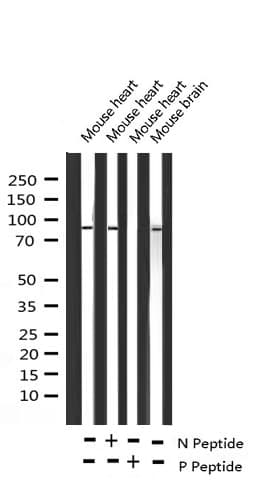 NR3C1/Glucocorticoid Receptor Antibody (phospho-Ser203)