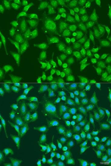 Polyclonal Rabbit anti-Human CENPQ Antibody (IF)
