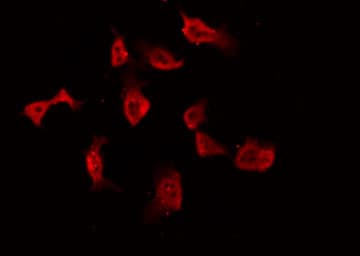 PRKCA / PKC-Alpha Antibody