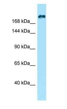 Polyclonal Rabbit anti-Human KIF21B Antibody (aa259-308, WB)
