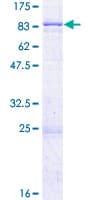Human SPTLC2 / LCB2 Protein (Recombinant GST)