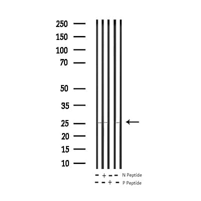 EIF4E Antibody (phospho-Ser209)