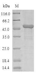 Human COMMD1 Protein (Recombinant GST, N-terminus)
