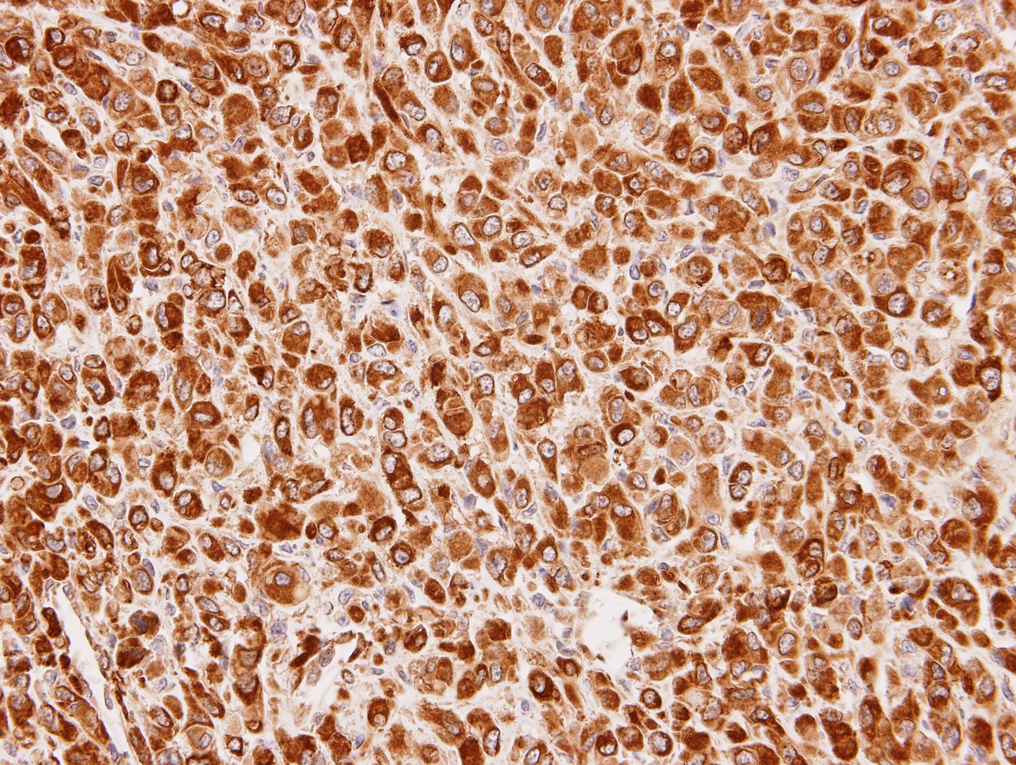 Polyclonal Rabbit anti-Human CUL7 Antibody (aa1370-1698, IHC, WB)