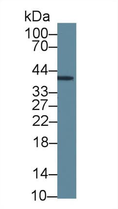 INHA / Inhibin Alpha Antibody
