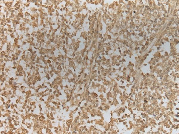 ZNF8 Antibody