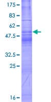 Human TSPAN1 / TM4SF Protein (Recombinant GST)