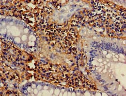 NCF1 / p47phox / p47 phox Antibody