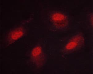 CAMK4 / CaMK IV Antibody (phospho-Thr196,pThr200)